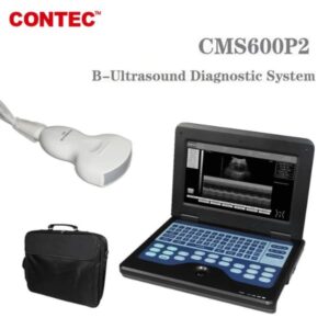 2024 Portable Ultrasound Scanner One Ticket